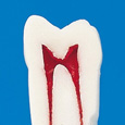 歯内療法用模型歯（ネジなし） [A12-500]